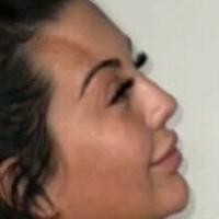 Chlofans Naken