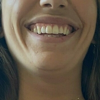 colette_duval Naken