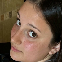 keshaortegafree Naken