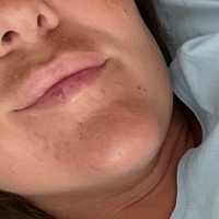 naughty_katarina_free Naken