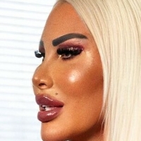 Real Barbie of Berlin Naken