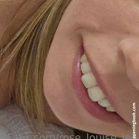 rose_louise_lee Naken